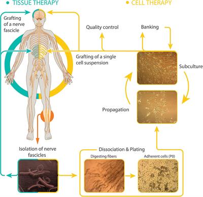 Human Schwann Cell Transplantation for Spinal Cord Injury: Prospects and Challenges in Translational Medicine